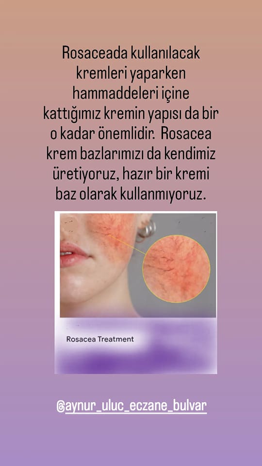 Rosacea Treatment<